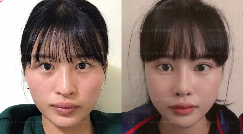AB Plastic Surgery